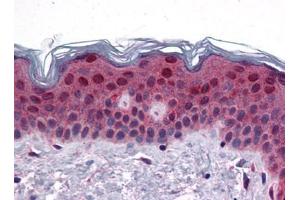 Human Skin: Formalin-Fixed, Paraffin-Embedded (FFPE) (FAM120B antibody  (C-Term))
