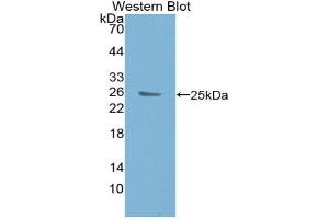 Western blot analysis of the recombinant protein. (BCL9 antibody  (AA 1119-1328))