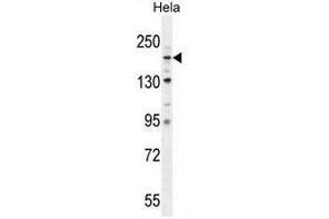 COL4A2 Antibody (N-term) western blot analysis in Hela cell line lysates (35µg/lane). (COL4a2 antibody  (Chain alpha 2, N-Term))