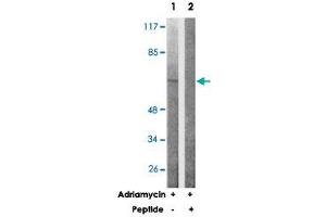 Western blot analysis of extracts from COS-7 cells treated with Adriamycin (0. (PRKAA1 antibody)