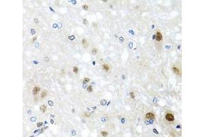 Immunohistochemistry of paraffin-embedded Rat brain using SAFB2 Polyclonal Antibody at dilution of 1:100 (40x lens). (SAFB2 antibody)