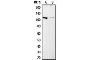 Western blot analysis of Collagen 6 alpha 2 expression in HepG2 (A), HT29 (B) whole cell lysates. (COL6A2 antibody  (Center))