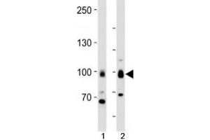 Western blot analysis of lysate from 1) MCF-7 cells and 2) human brain tissue using TLE1 antibody at 1:1000. (TLE1 antibody  (N-Term))