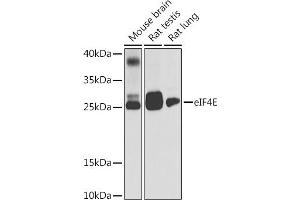 Western blot analysis of extracts of various cell lines, using eIF4E antibody (ABIN6134340, ABIN6140083, ABIN6140085 and ABIN6221700) at 1:1000 dilution. (EIF4E antibody  (AA 1-100))