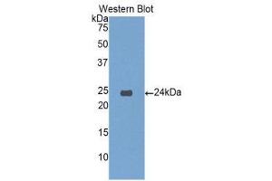 Western Blotting (WB) image for anti-Insulin-Like Growth Factor Binding Protein 6 (IGFBP6) (AA 51-226) antibody (ABIN3208922) (IGFBP6 antibody  (AA 51-226))