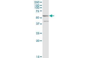 ME1 monoclonal antibody (M01), clone 2A2. (ME1 antibody  (AA 1-572))