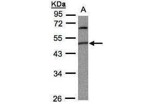 WB Image Sample(30 ug whole cell lysate) A:293T 10% SDS PAGE antibody diluted at 1:1000 (PIGK antibody)