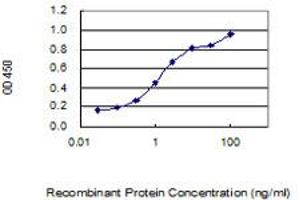 Detection limit for recombinant GST tagged SCML4 is 0. (SCML4 antibody  (AA 1-305))