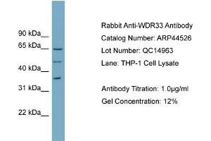 WB Suggested Anti-WDR33  Antibody Titration: 0.