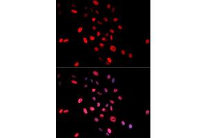 Immunofluorescence analysis of MCF-7 cells using Phospho-Jun-S63 antibody (ABIN5969905).