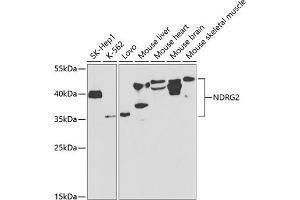 Western blot analysis of extracts of various cell lines, using NDRG2 antibody (ABIN6128325, ABIN6144451, ABIN6144452 and ABIN6220946) at 1:1000 dilution.