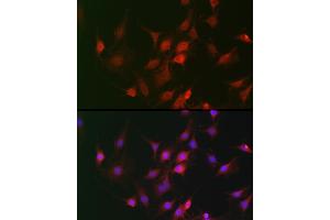 Immunohistochemistry of paraffin-embedded mouse lung using GAPDH Rabbit pAb (ABIN3020537, ABIN3020538 and ABIN3020539) at dilution of 1:100 (40x lens). (GAPDH antibody  (AA 1-335))