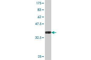 Western Blot detection against Immunogen (37. (CMPK2 antibody  (AA 151-250))
