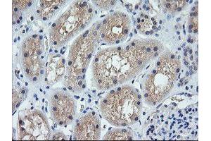 Image no. 1 for anti-Cancer/testis Antigen 1B (CTAG1B) antibody (ABIN1499890) (CTAG1B antibody)