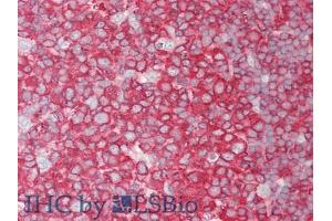 IHC-P analysis of Human Tonsil Tissue, with HE staining. (PCSK9 antibody  (AA 454-679))
