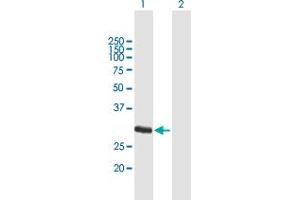 Western Blot analysis of FCN1 expression in transfected 293T cell line by FCN1 MaxPab polyclonal antibody. (FCN1 antibody  (AA 1-326))