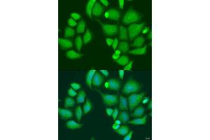 Immunofluorescence analysis of U2OS cells using CAPN2 antibody. (Calpain 2 antibody  (AA 350-680))