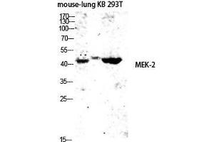 Western Blot (WB) analysis of Mouse Lung KB 293T lysis using MEK-2 antibody. (MEK2 antibody  (Thr38))