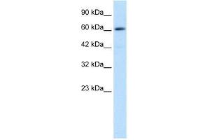 Human Jurkat; WB Suggested Anti-ZNF499 Antibody Titration: 0. (ZBTB45 antibody  (Middle Region))