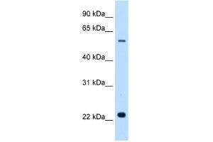 WB Suggested Anti-SLC17A5 Antibody Titration:  0. (Solute Carrier Family 17 (Acidic Sugar Transporter), Member 5 (SLC17A5) (N-Term) antibody)