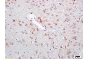Formalin-fixed and paraffin embedded rat brain labeled with Rabbit Anti GAD67/GAD1 Polyclonal Antibody, Unconjugated (ABIN674679) at 1:200 followed by conjugation to the secondary antibody and DAB staining (GAD antibody  (AA 455-594))
