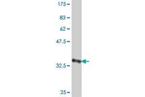 CRAT antibody  (AA 445-544)