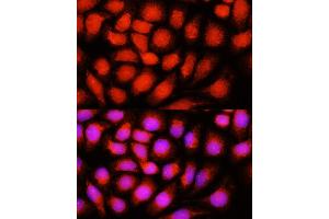 Immunofluorescence analysis of HeLa cells using ACADVL antibody  at dilution of 1:100 (40x lens). (ACADVL antibody  (AA 1-140))