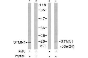 Image no. 2 for anti-Stathmin 1 (STMN1) (pSer24) antibody (ABIN196968) (Stathmin 1 antibody  (pSer24))