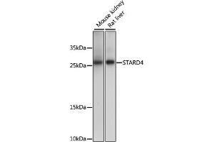 Western blot analysis of extracts of various cell lines, using ST antibody (ABIN7270584) at 1000 dilution. (STARD4 antibody  (AA 1-100))