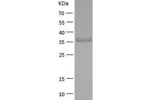Western Blotting (WB) image for Transmembrane Protease, serine 4 (TMPRSS4) (AA 52-435) protein (His tag) (ABIN7125479) (TMPRSS4 Protein (AA 52-435) (His tag))