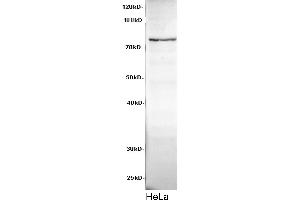 Western Blotting (WB) image for anti-Cadherin 8 (CDH8) antibody (ABIN5958176) (Cadherin 8 antibody)