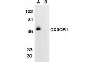 Image no. 1 for anti-Chemokine (C-X3-C Motif) Receptor 1 (CX3CR1) (AA 175-189) antibody (ABIN319015) (CX3CR1 antibody  (AA 175-189))