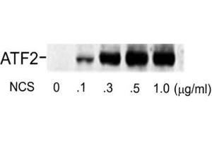 Western blot of human melanoma cells incubated with varying doses of the radiomimetic drug NCS showing specific immuno-labeling of the ~74k ATF2 protein phosphorylated at Ser490 and Ser498. (ATF2 antibody  (pSer490, pSer498))