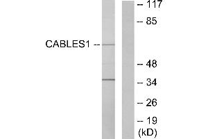 Western blot analysis of extracts from LOVO cells, using Ik3-1 antibody.