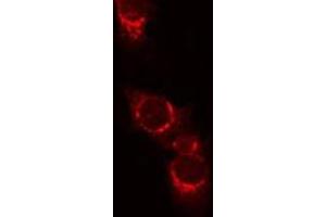 Immunofluorescence (fixed cells) (IF/ICC) image for anti-Protein tyrosine Phosphatase, Receptor Type, C (PTPRC) (C-Term) antibody (ABIN6266361)