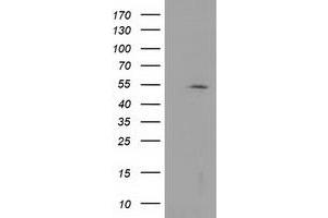 Western Blotting (WB) image for anti-Histone Deacetylase 1 (HDAC1) antibody (ABIN1498605) (HDAC1 antibody)