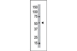 Image no. 1 for anti-Mannosyl (Alpha-1,3-)-Glycoprotein beta-1,2-N-Acetylglucosaminyltransferase (MGAT1) (C-Term) antibody (ABIN357695) (MGAT1 antibody  (C-Term))