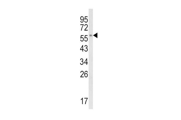 CYP8B1 antibody  (C-Term)