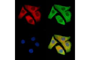 ABIN7095413 and ABIN7099470 staining Hela cells by IF/ICC.