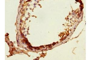 Immunohistochemistry of paraffin-embedded human testis tissue using ABIN7160476 at dilution of 1:100 (MLF1 antibody  (AA 1-268))