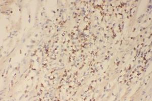 IHC analysis of Profilin 1 using anti-Profilin 1 antibody (ABIN3043603). (PFN1 antibody  (C-Term))
