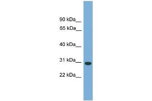 WB Suggested Anti-CA5B Antibody Titration: 0. (CA5B antibody  (N-Term))