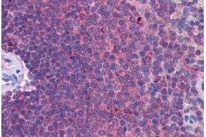 Human Spleen: Formalin-Fixed, Paraffin-Embedded (FFPE) (IFIH1 antibody  (AA 612-661))