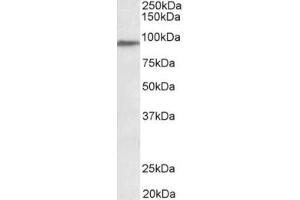 Western Blotting (WB) image for anti-Patched Domain Containing 3 (PTCHD3) (Internal Region) antibody (ABIN2465068) (PTCHD3 antibody  (Internal Region))
