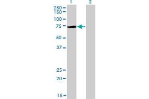 Western Blot analysis of PIAS3 expression in transfected 293T cell line by PIAS3 monoclonal antibody (M03), clone 4F12. (PIAS3 antibody  (AA 453-550))