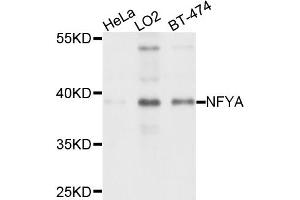 Western blot analysis of extracts of various cell lines, using NFYA antibody (ABIN4904531) at 1:1000 dilution.