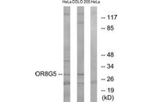 Western blot analysis of extracts from HeLa/COLO cells, using OR8G5 Antibody.