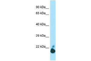 WB Suggested Anti-TIGIT Antibody Titration: 1.