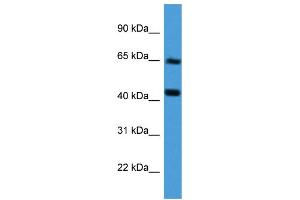 Western Blotting (WB) image for anti-Collagen, Type VIII, alpha 2 (COL8A2) (Middle Region) antibody (ABIN2788308) (COL8a2 antibody  (Middle Region))