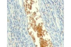 Formalin-fixed, paraffin-embedded human tonsil stained with AMPD3 antibody (clone ETAD3-1). (AMPD3 antibody)